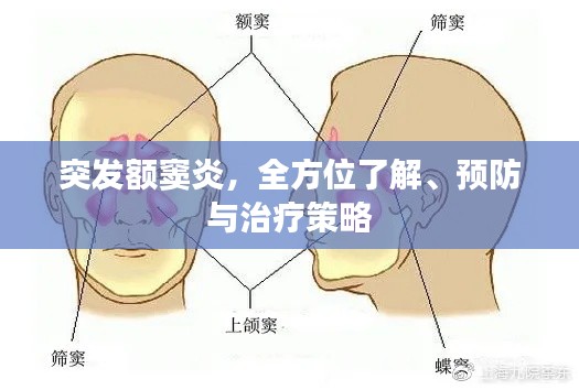 突发额窦炎,全方位了解、预防与治疗策略