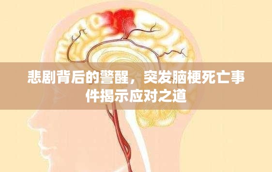 悲剧背后的警醒,突发脑梗死亡事件揭示应对之道