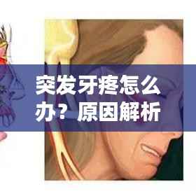 突发牙疼怎么办?原因解析、应急措施及预防指南